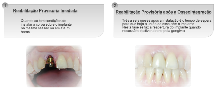 Reabilitação Provisória