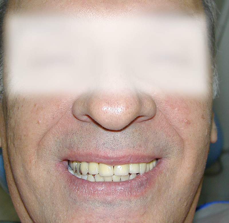 Caso 09 - Dentística (estética)