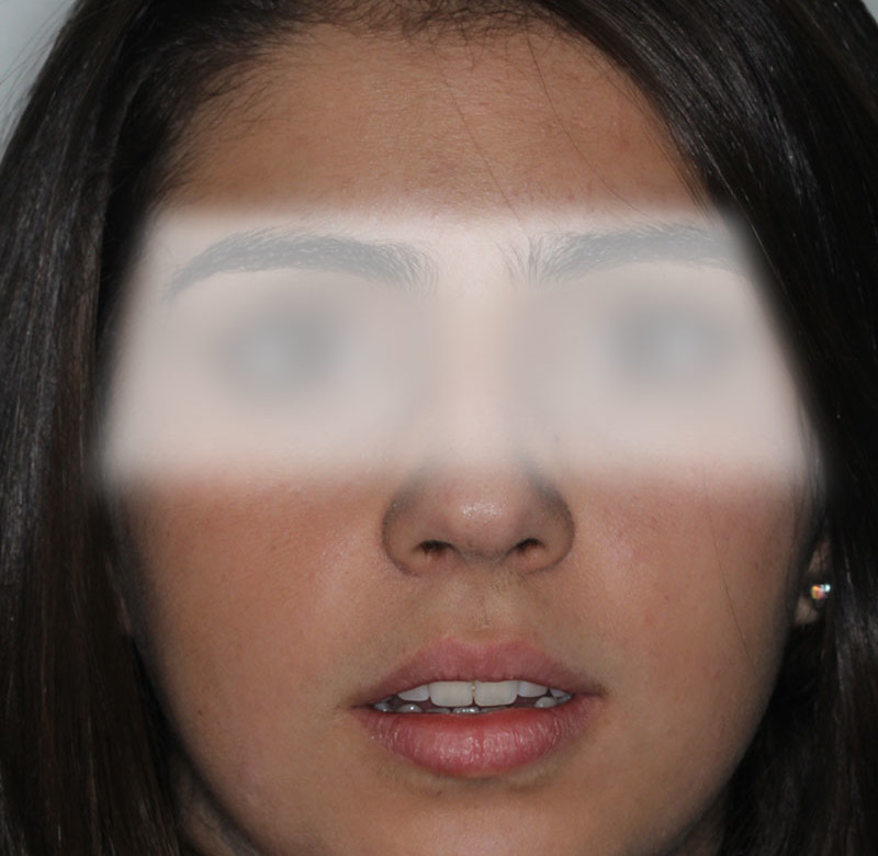 Caso 02 - Dentística (estética)