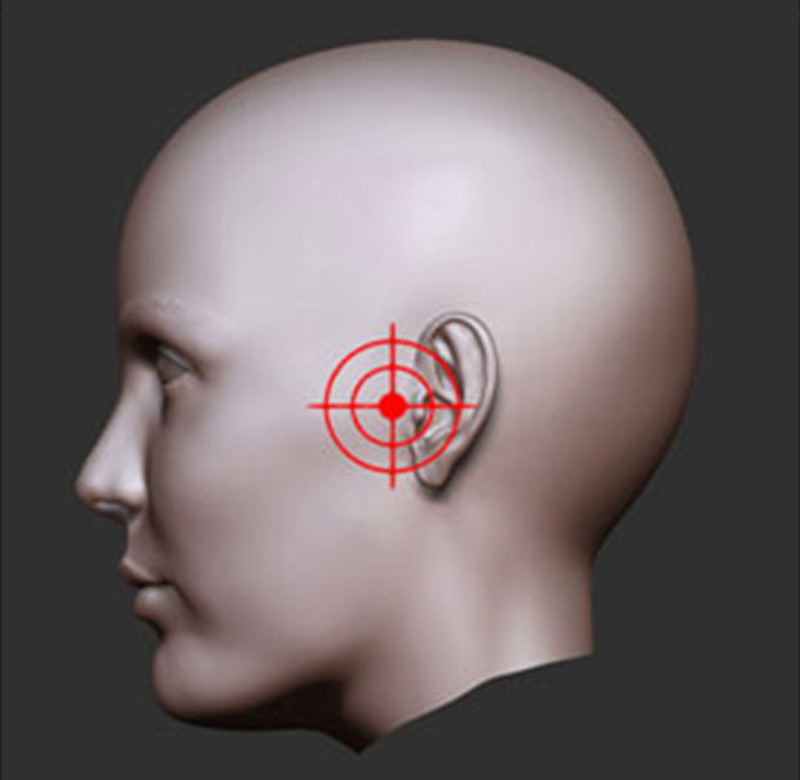 Cirurgia Buco-Maxilo-Facil ATM(DTM)