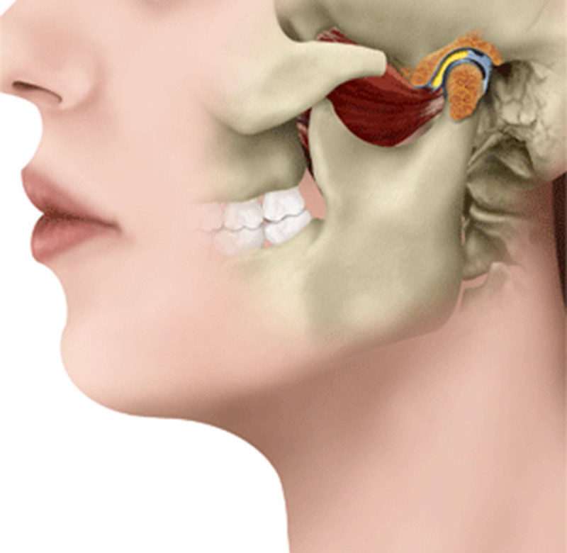 Cirurgia Buco-Maxilo-Facil ATM(DTM)