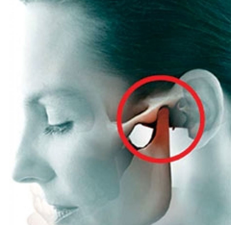 Cirurgia Buco-Maxilo-Facil ATM(DTM)