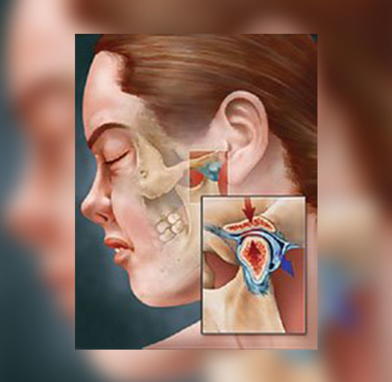 Cirurgia Buco-Maxilo-Facil ATM(DTM)